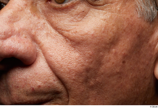 HD Face Skin Hector Palau cheek face nose skin pores…